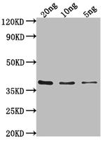 Salmonella typhi hupB Polyclonal Antibody