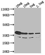 btuB Polyclonal Antibody