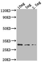 AADB Polyclonal Antibody