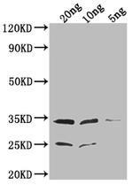 EPTA Polyclonal Antibody