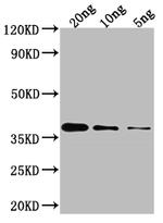 GLMU Polyclonal Antibody