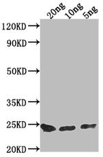 PNCC Polyclonal Antibody