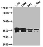 RCSF Polyclonal Antibody
