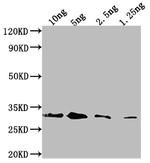 Endochitinase B Antibody in Western Blot (WB)