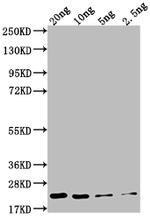NCE2 Polyclonal Antibody