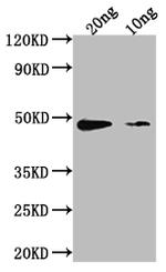Staphylococcus aureus neutral proteinase Antibody in Western Blot (WB)