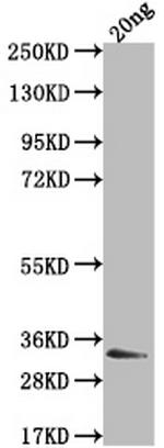Epstein Barr Virus Nuclear Antigen 3 Polyclonal Antibody