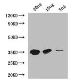 MTB Polyclonal Antibody