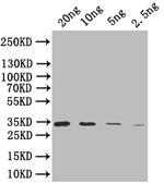 SIGB Polyclonal Antibody