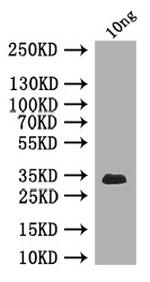 Clathrin Heavy Chain Polyclonal Antibody