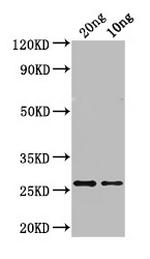 ASE1 Polyclonal Antibody