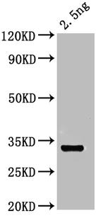 OTOP1 Polyclonal Antibody