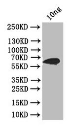 Pneumolysin Polyclonal Antibody