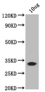 bamB Antibody in Western Blot (WB)