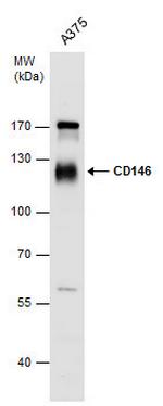 CD146 Antibody in Western Blot (WB)