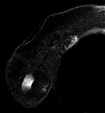 ALDH1A2 Polyclonal Antibody