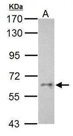 CYP26C1 Polyclonal Antibody