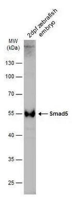 SMAD5 Polyclonal Antibody