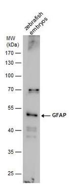 GFAP Antibody in Western Blot (WB)