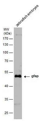 GFAP Antibody in Western Blot (WB)