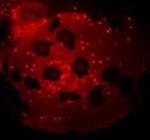 ATP6V1A Antibody in Immunohistochemistry (IHC)