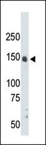 CDK12 Antibody in Western Blot (WB)