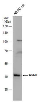 ASMT Antibody in Western Blot (WB)