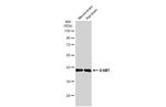 ASMT Polyclonal Antibody
