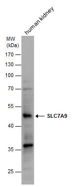 SLC7A9 Polyclonal Antibody