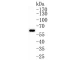 GRB7 Antibody in Western Blot (WB)