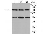 Bcl-rambo Antibody in Western Blot (WB)