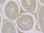 TRPV6 Antibody in Immunohistochemistry (Paraffin) (IHC (P))