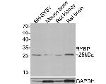 RYBP Polyclonal Antibody