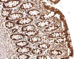 PSMC5 Antibody in Immunohistochemistry (Paraffin) (IHC (P))