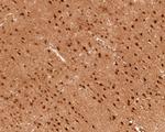 PSMC6 Antibody in Immunohistochemistry (Paraffin) (IHC (P))