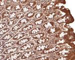 LIGHT Antibody in Immunohistochemistry (Paraffin) (IHC (P))