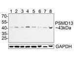 PSMD13 Antibody in Western Blot (WB)