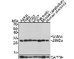 PSMA4 Antibody in Western Blot (WB)