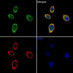 PSMB3 Polyclonal Antibody