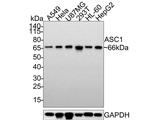 ASC1 Polyclonal Antibody