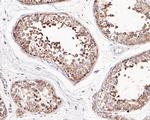 AIMP2 Antibody in Immunohistochemistry (Paraffin) (IHC (P))