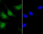 GLI1 Polyclonal Antibody