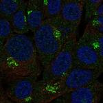 B3GALNT2 Antibody in Immunocytochemistry (ICC/IF)