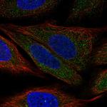 PDPK1 Polyclonal Antibody
