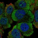 PTPRH Polyclonal Antibody