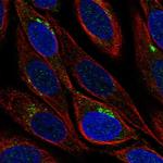 GLT8D1 Polyclonal Antibody