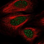 WRN Polyclonal Antibody