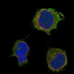 PSTPIP1 Polyclonal Antibody