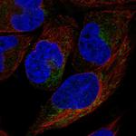 CYB5R1 Antibody in Immunocytochemistry (ICC/IF)