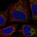 C17orf80 Polyclonal Antibody